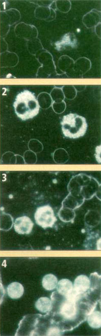 Dunkelfeld- Mikroskopie